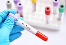 Bone Marrow Transplant in India: Turning challenges into triumphs